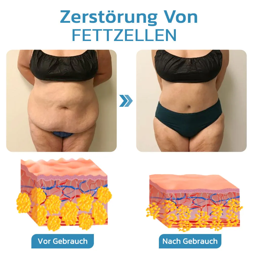 Furzero Slendery Ultraschall Lymphmassagegerts