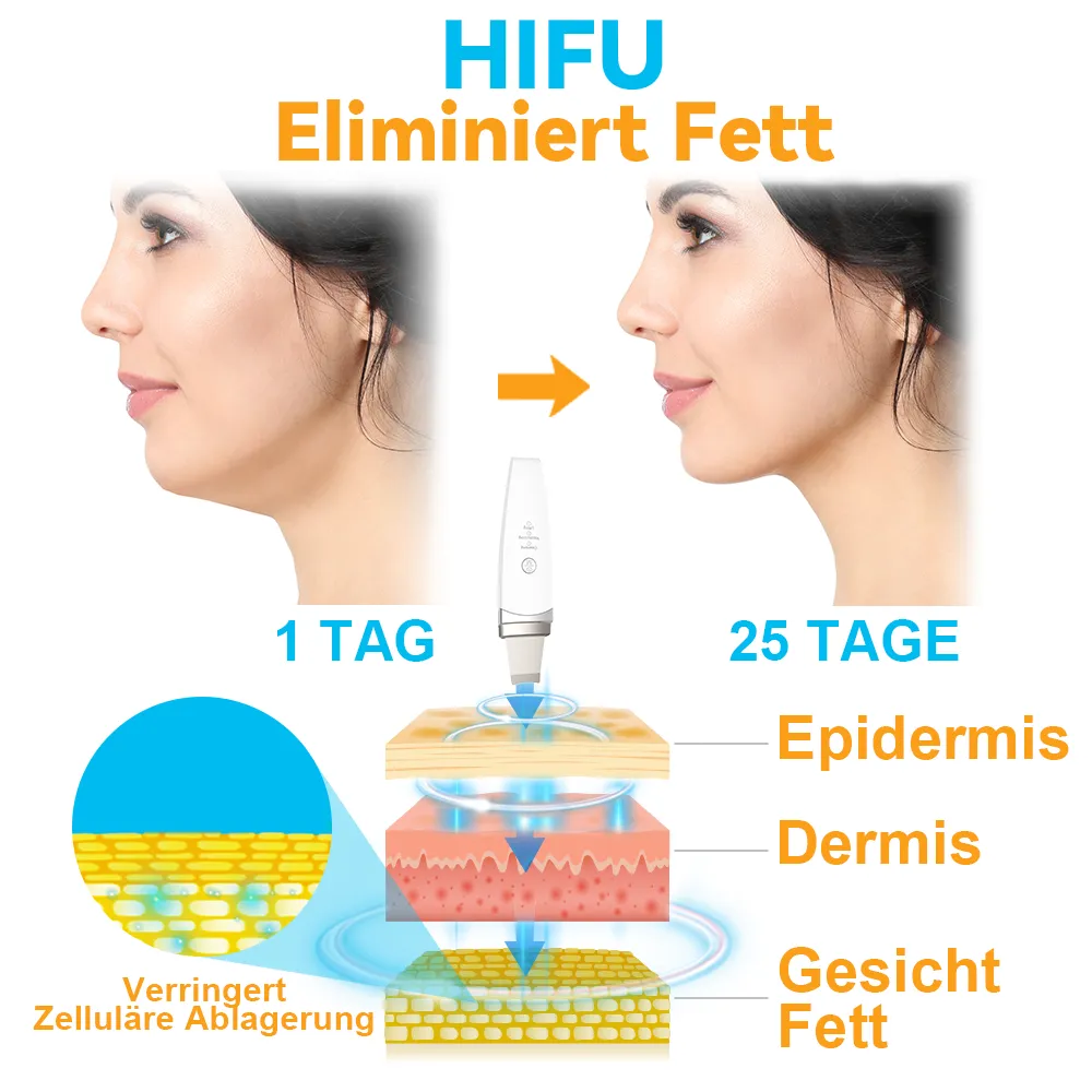 GFOUK Hochintensiver Fokussierter Ultraschall Facelifting Gert