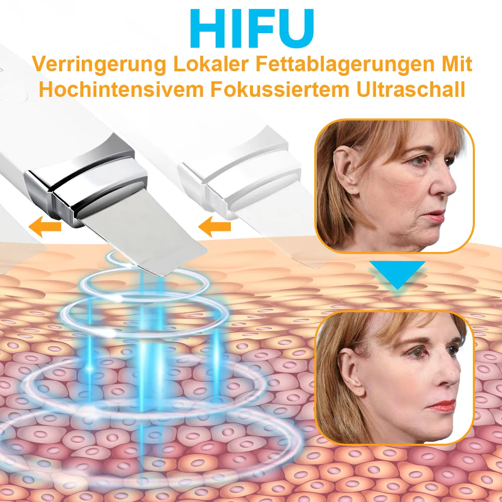GFOUK Hochintensiver Fokussierter Ultraschall Facelifting Gert