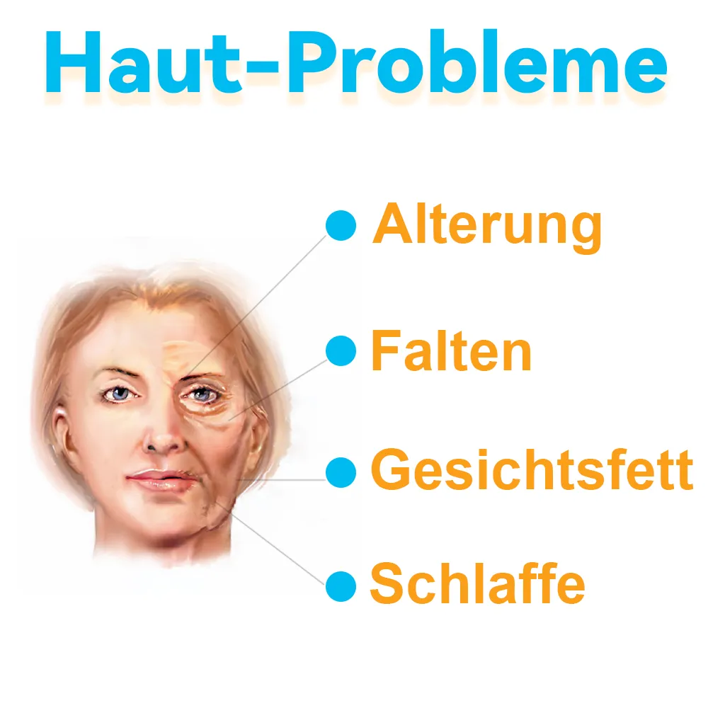 GFOUK Hochintensiver Fokussierter Ultraschall Facelifting Gert